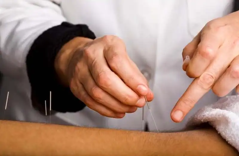 What are the requirements to become an acupuncturist